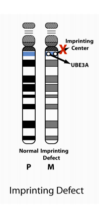Chromosome 15 Imprinting Center Defect