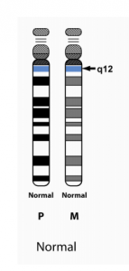 Normal Chromosome 15